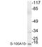 S100 Calcium Binding Protein A10 antibody, LS-B12569, Lifespan Biosciences, Western Blot image 