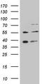 G Protein-Coupled Receptor Kinase 4 antibody, TA806069, Origene, Western Blot image 