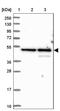 Bleomycin Hydrolase antibody, NBP1-88640, Novus Biologicals, Western Blot image 