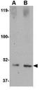 Sprouty Related EVH1 Domain Containing 1 antibody, GTX85376, GeneTex, Western Blot image 
