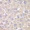 Sterol O-Acyltransferase 1 antibody, LS-C333990, Lifespan Biosciences, Immunohistochemistry paraffin image 