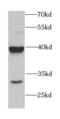 ARSA antibody, FNab00643, FineTest, Western Blot image 