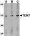 Plexin Domain Containing 1 antibody, orb74886, Biorbyt, Western Blot image 