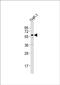 Zinc Finger Protein 92 antibody, PA5-49430, Invitrogen Antibodies, Western Blot image 