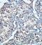 Proteasomal ATPase-associated factor 1 antibody, orb77802, Biorbyt, Immunohistochemistry paraffin image 