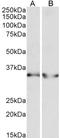 Lactate Dehydrogenase B antibody, TA327769, Origene, Western Blot image 