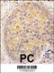 Calcium/Calmodulin Dependent Protein Kinase Kinase 2 antibody, 62-672, ProSci, Immunohistochemistry paraffin image 