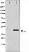Cyclin Dependent Kinase 5 antibody, orb106471, Biorbyt, Western Blot image 