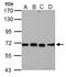Nuclear pore glycoprotein p62 antibody, GTX102359, GeneTex, Western Blot image 