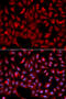 Siah E3 Ubiquitin Protein Ligase 1 antibody, 18-666, ProSci, Immunofluorescence image 