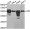 Vimentin antibody, A2666, ABclonal Technology, Western Blot image 