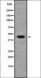 Carbohydrate Sulfotransferase 11 antibody, orb338123, Biorbyt, Western Blot image 