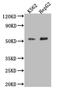 Monocarboxylate transporter 2 antibody, CSB-PA021414LA01HU, Cusabio, Western Blot image 