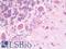 Disabled homolog 1 antibody, LS-B10921, Lifespan Biosciences, Immunohistochemistry paraffin image 