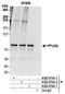 U4/U6 small nuclear ribonucleoprotein Prp3 antibody, A302-073A, Bethyl Labs, Immunoprecipitation image 