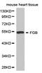 Fibrinogen Beta Chain antibody, TA327042, Origene, Western Blot image 