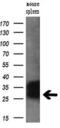 Regulator of G-protein signaling 16 antibody, M04881, Boster Biological Technology, Western Blot image 