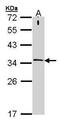 Syntaxin 1A antibody, GTX106365, GeneTex, Western Blot image 