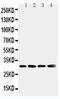Superoxide Dismutase 3 antibody, PA5-80051, Invitrogen Antibodies, Western Blot image 