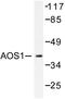 SUMO1 Activating Enzyme Subunit 1 antibody, AP06444PU-N, Origene, Western Blot image 