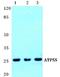 Distal Membrane Arm Assembly Complex 2 Like antibody, A13337-1, Boster Biological Technology, Western Blot image 