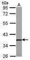 Dickkopf WNT Signaling Pathway Inhibitor 3 antibody, LS-B10864, Lifespan Biosciences, Western Blot image 