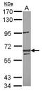 Lin-54 DREAM MuvB Core Complex Component antibody, NBP2-19357, Novus Biologicals, Western Blot image 