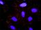 Transducin Beta Like 1 X-Linked antibody, H00006907-M07, Novus Biologicals, Proximity Ligation Assay image 