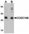 Coiled-coil domain-containing protein 106 antibody, TA319903, Origene, Western Blot image 