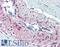 SSX Family Member 4B antibody, LS-B3514, Lifespan Biosciences, Immunohistochemistry frozen image 