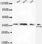 General Transcription Factor IIB antibody, LS-C178298, Lifespan Biosciences, Western Blot image 