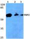 Short transient receptor potential channel 2 antibody, PA5-36485, Invitrogen Antibodies, Western Blot image 