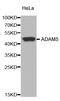 Putative disintegrin and metalloproteinase domain-containing protein 5 antibody, STJ28178, St John