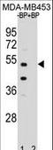 POC1 Centriolar Protein B antibody, LS-C160592, Lifespan Biosciences, Western Blot image 