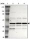 Immunoglobulin Binding Protein 1 antibody, NBP1-83126, Novus Biologicals, Western Blot image 