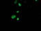 SSX Family Member 1 antibody, TA502728, Origene, Immunofluorescence image 