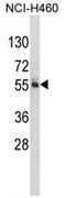 FTO Alpha-Ketoglutarate Dependent Dioxygenase antibody, AP17404PU-N, Origene, Western Blot image 