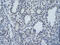 SF3b155 antibody, ARP40249_T100, Aviva Systems Biology, Immunohistochemistry paraffin image 