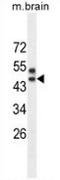 Sprouty Related EVH1 Domain Containing 3 antibody, AP54031PU-N, Origene, Western Blot image 