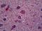Oligodendrocyte Transcription Factor 2 antibody, orb95034, Biorbyt, Immunohistochemistry paraffin image 