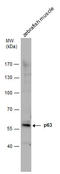 Tumor Protein P63 antibody, GTX124660, GeneTex, Western Blot image 