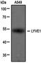 Lymphatic Vessel Endothelial Hyaluronan Receptor 1 antibody, NB100-725, Novus Biologicals, Western Blot image 