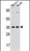 Leucine Zipper Protein 2 antibody, PA5-48523, Invitrogen Antibodies, Western Blot image 