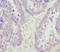 Minichromosome Maintenance Complex Component 3 antibody, A68307-100, Epigentek, Immunohistochemistry paraffin image 