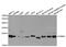 Proteasome Subunit Beta 4 antibody, MBS2516709, MyBioSource, Western Blot image 