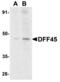 DNA Fragmentation Factor Subunit Alpha antibody, MBS150439, MyBioSource, Western Blot image 