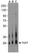 T Cell Immunoreceptor With Ig And ITIM Domains antibody, TA355124, Origene, Western Blot image 