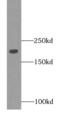 Myosin-2 antibody, FNab05518, FineTest, Western Blot image 