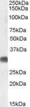 Steroid 5 Alpha-Reductase 2 antibody, PA5-19091, Invitrogen Antibodies, Western Blot image 