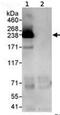 Lysine Demethylase 5A antibody, ab70892, Abcam, Immunoprecipitation image 